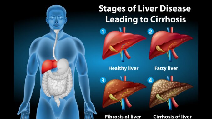 The Supplements with Healthy Liver Support